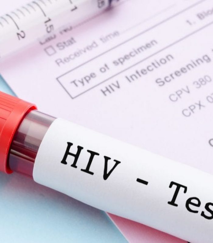 Regular Cannabis Use Reduces HIV Viral Load in PreClinical Trials