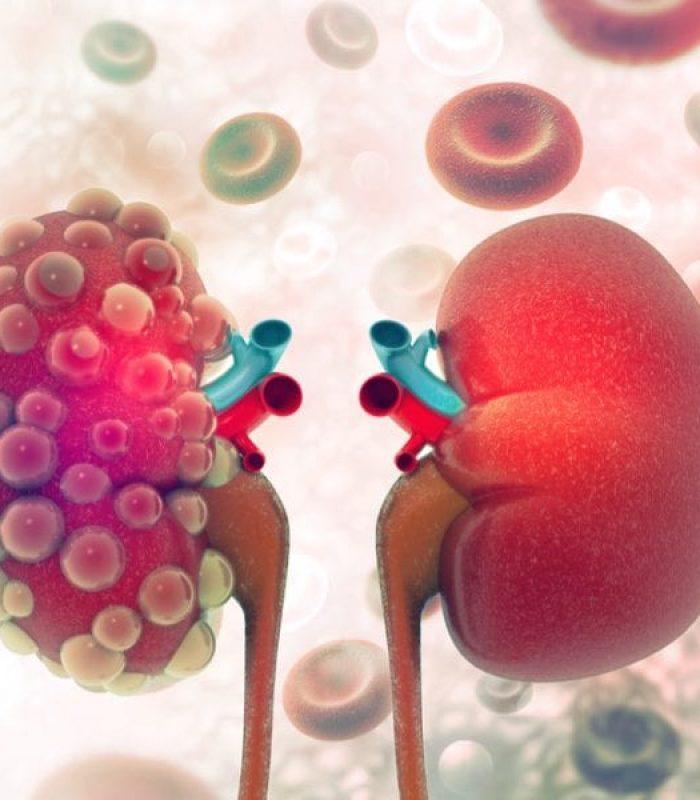 CBD Protects Kidney Health in Mice