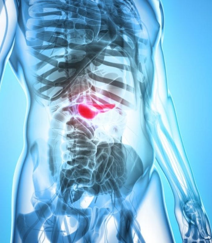 Cannabis Kills Pancreatic Cancer Cells in the Lab