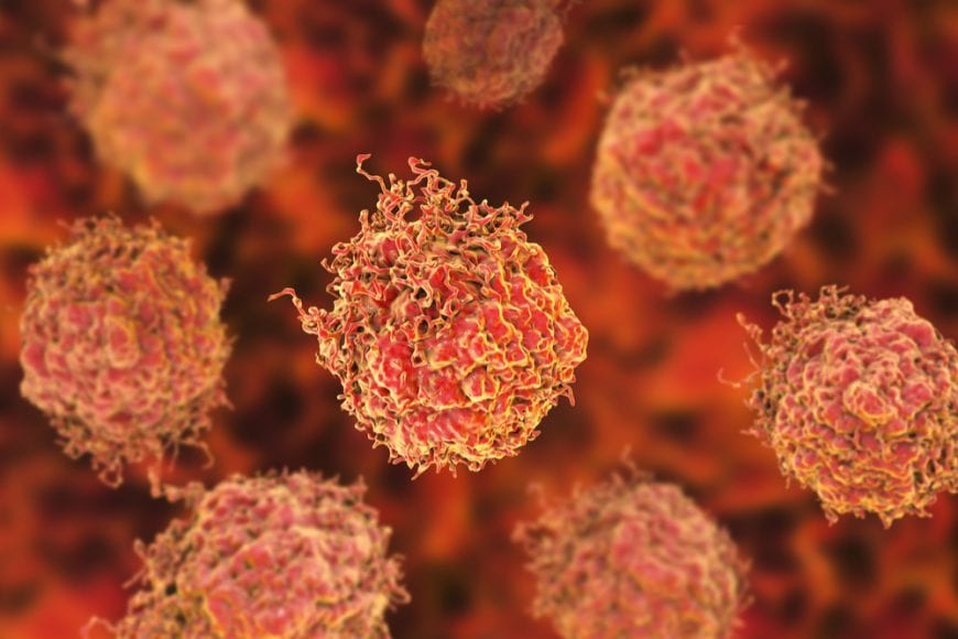 3D Image concept of Prostate Cancer Cells