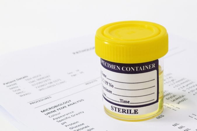 Campione di urina Detox di THC seduto sopra documenti