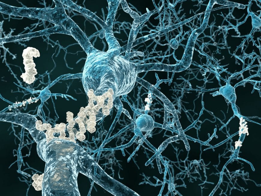 Neuroplasticity in dementia patients represented by image of a blocking proteins