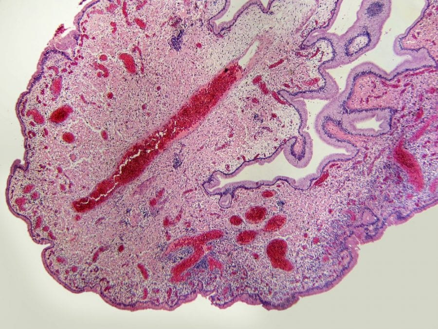 placenta, anandamide, CB1, CB2, cannabis, cannabis medica, cannabis ricreativa, gravidanza, prenatale, CBD, THC