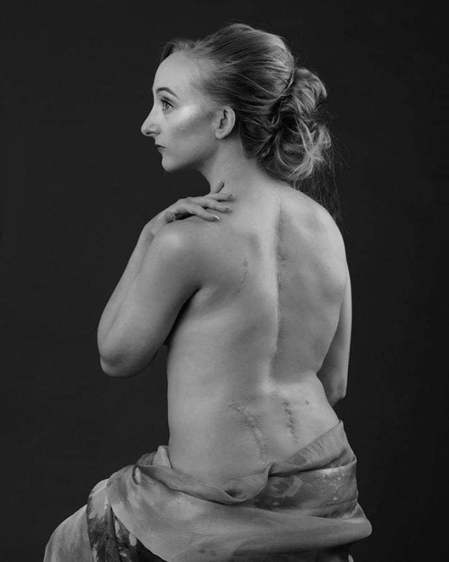 Image of woman with back injury