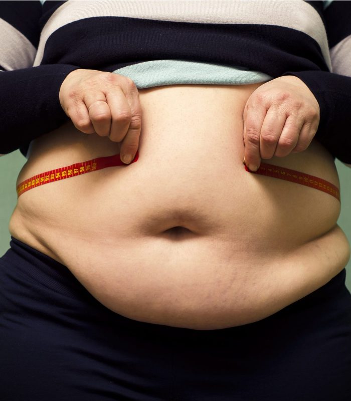 The Endocannabinoid System and Obesity