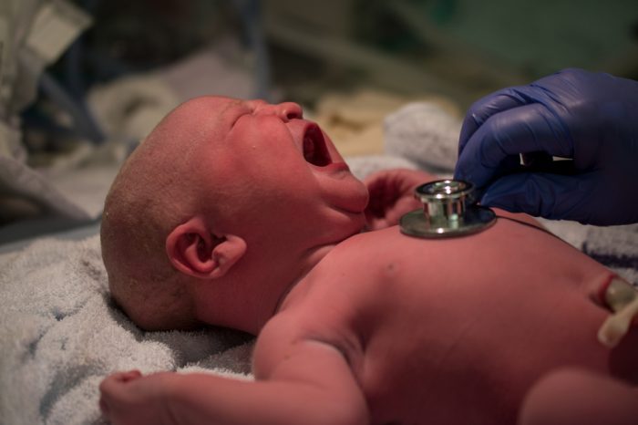 neonatal death represented by newborn