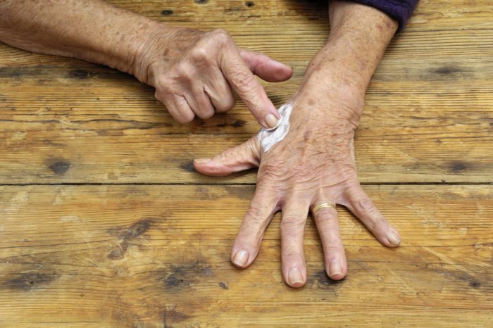 topical pain cream application onto hands