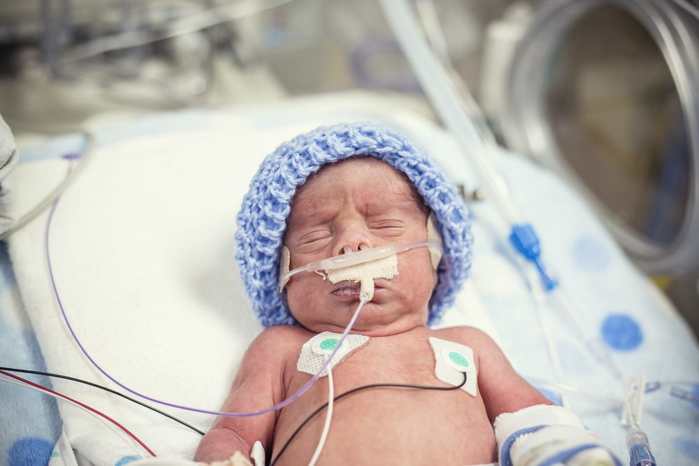 Cannabis Seizure Trial For Newborns With Brain Injury at Birth