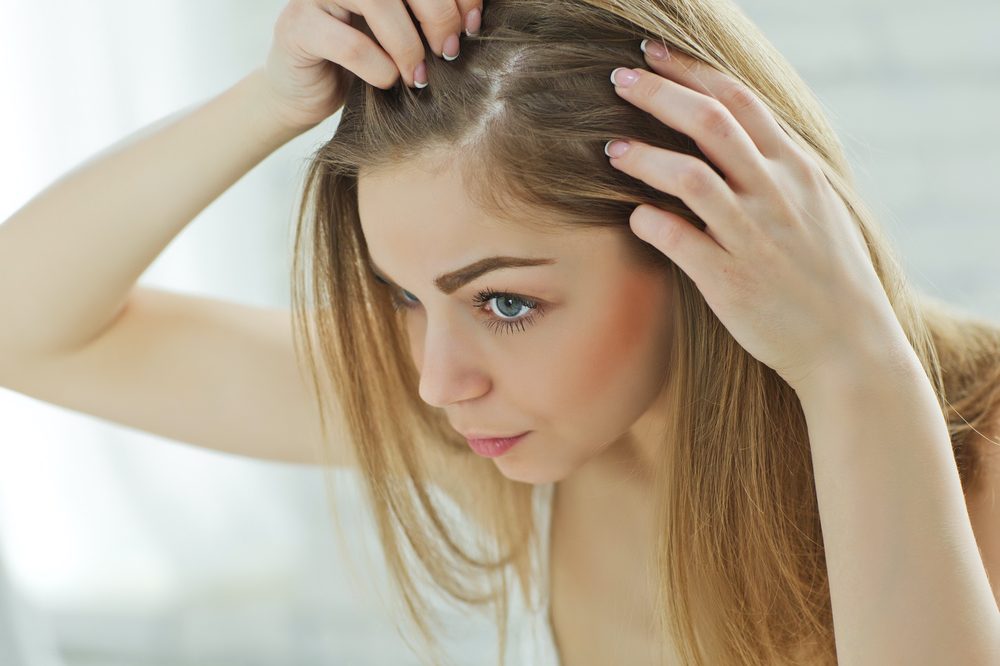 photo of How Successful is CBD as a DIY Dandruff Treatment? image